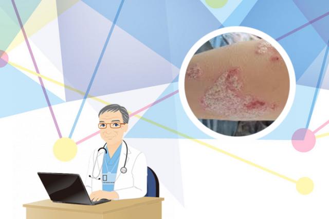 皮肤癣菌病能根治吗
