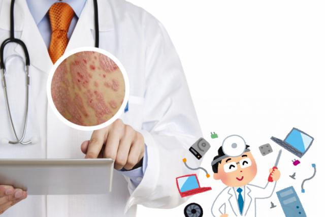 干性湿疹和银屑病区别图片