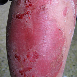 牜皮癣病初期症状图片